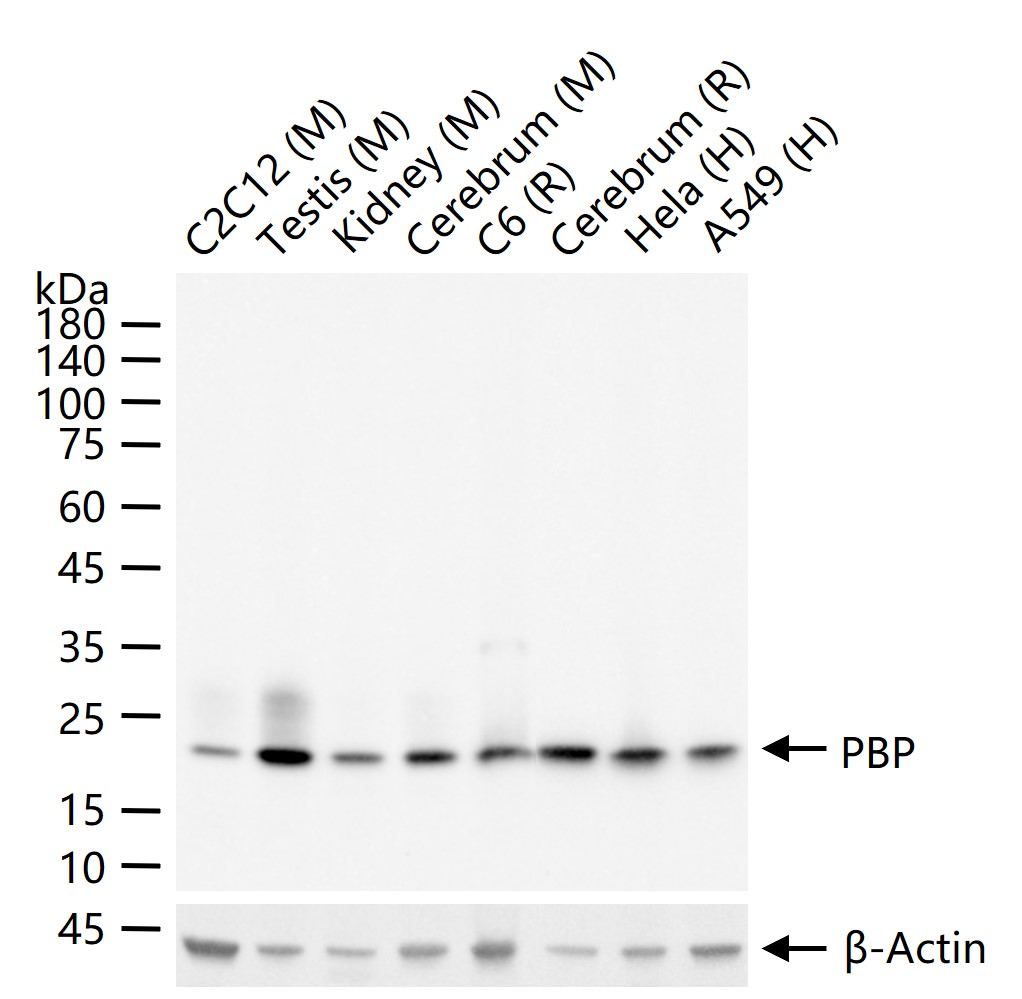 磷脂酰乙醇胺结合蛋白1重组兔单抗-bsm-61243R
