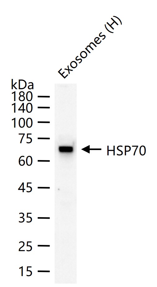 热休克蛋白-70重组兔单抗