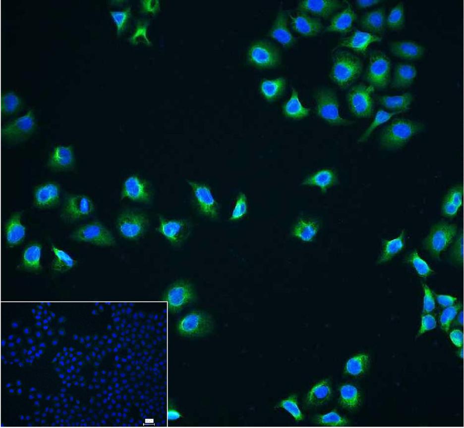 细胞核因子/k基因结合核因子单克隆抗体-bsm-33117M