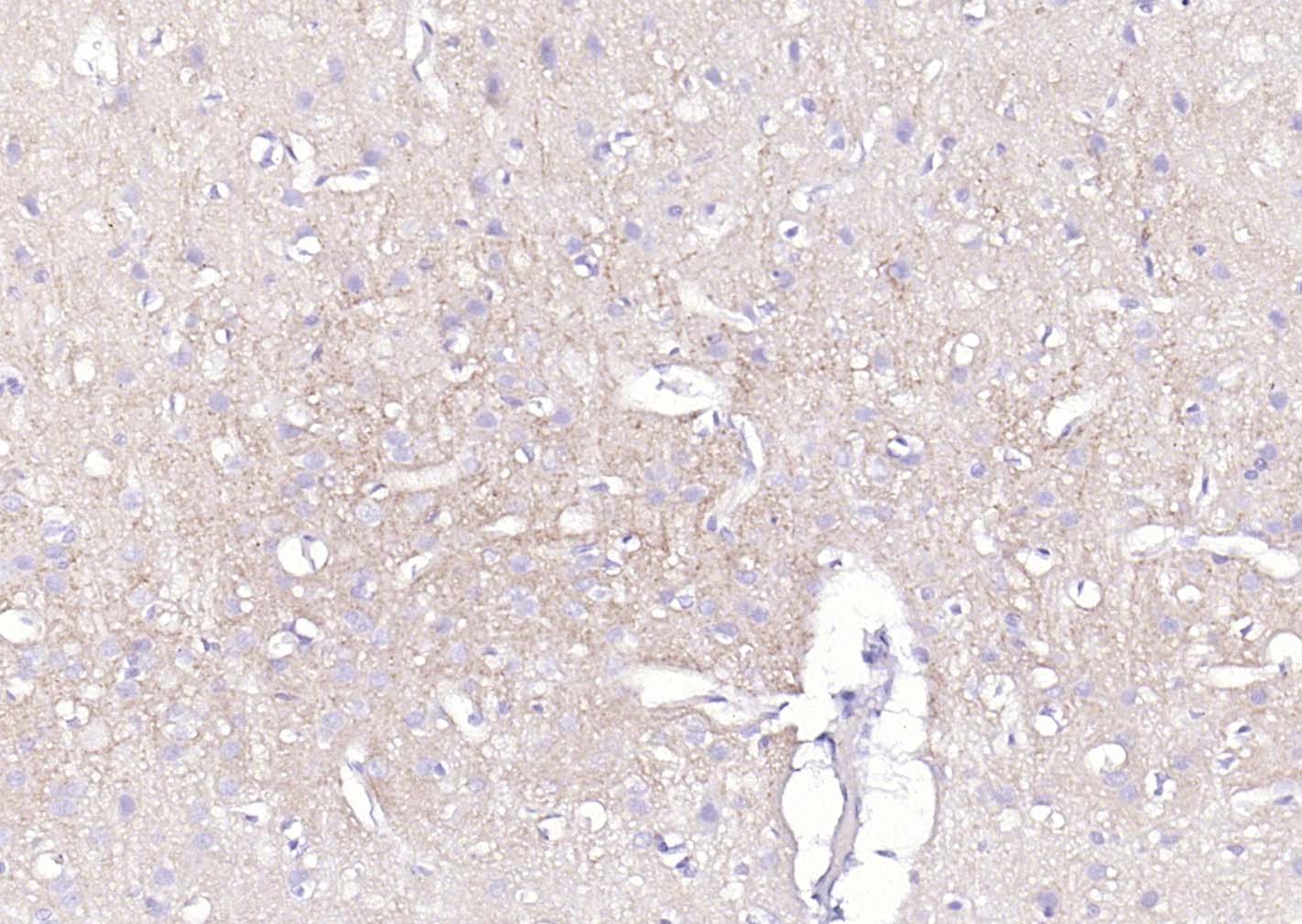 Na+/K+-ATPase α1 钠钾ATP酶α1抗体-bs-9570R