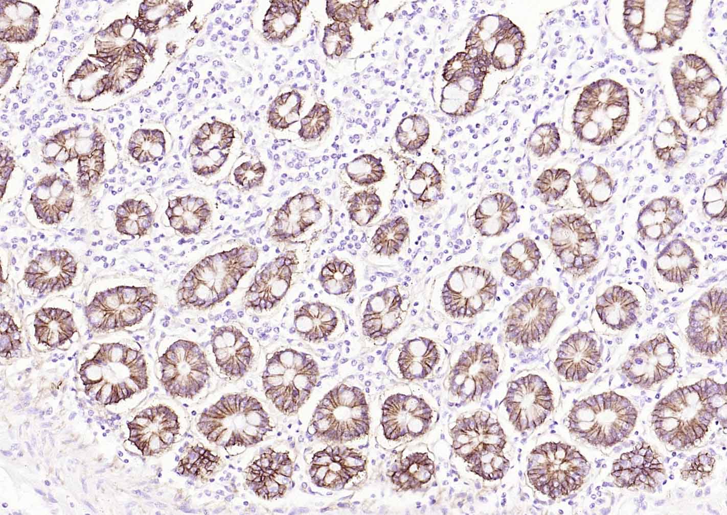 ATP1A1 Rabbit pAb (一抗) - IHC-P,IHC-F,IF | Bioss