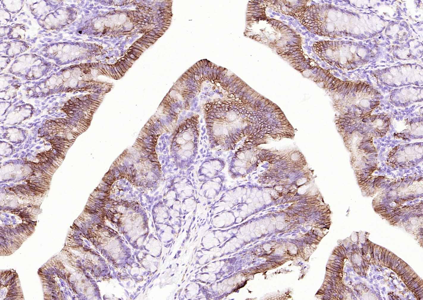 Na+/K+-ATPase α1 钠钾ATP酶α1抗体-bs-9570R