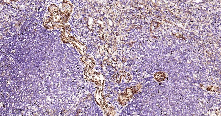 黑色素瘤细胞粘附分子CD146重组兔单抗