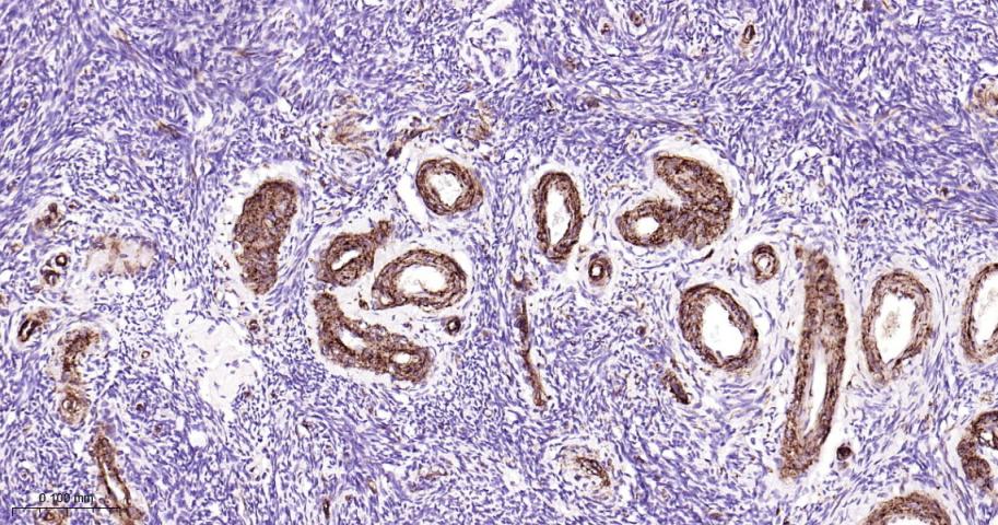 黑色素瘤细胞粘附分子CD146重组兔单抗