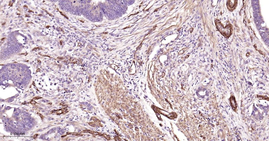 黑色素瘤细胞粘附分子CD146重组兔单抗
