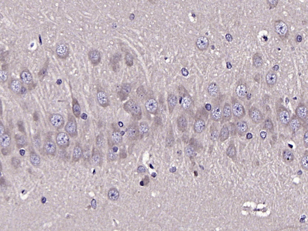 ATG13 Rabbit pAb (一抗) - IHC-P,IHC-F,IF | Bioss