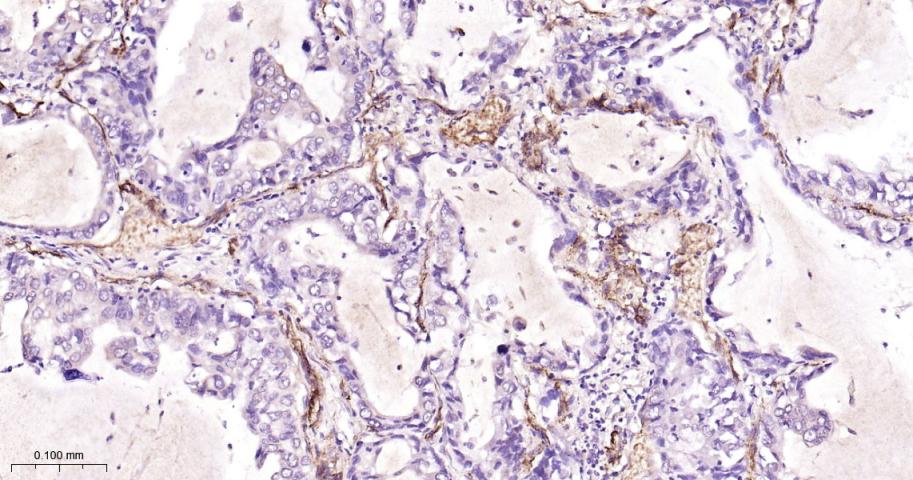 黑色素瘤细胞粘附分子CD146重组兔单抗