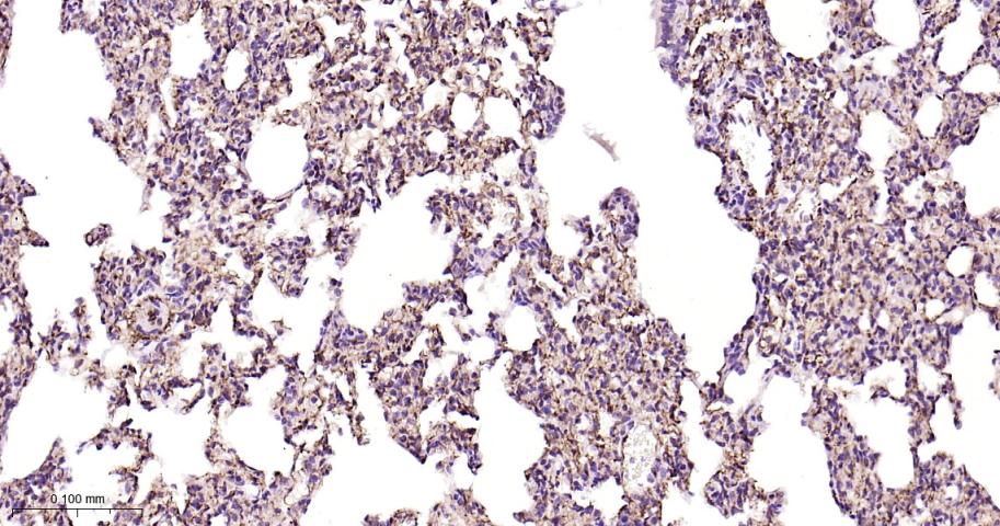 黑色素瘤细胞粘附分子CD146重组兔单抗