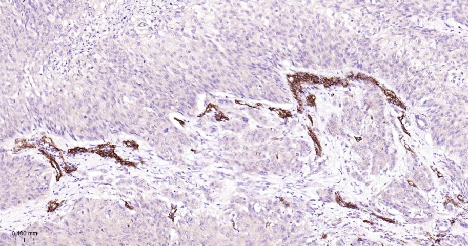 黑色素瘤细胞粘附分子CD146重组兔单抗