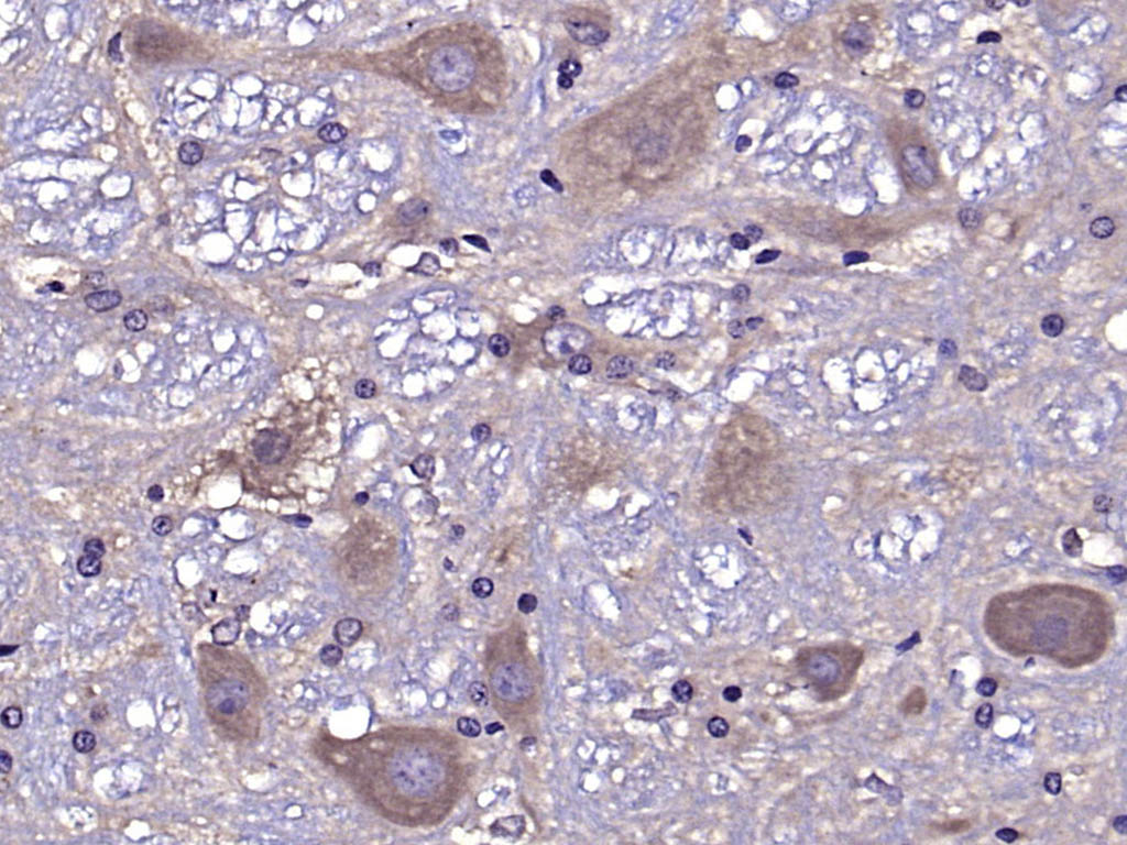 自噬相关蛋白13抗体-bs-3864R