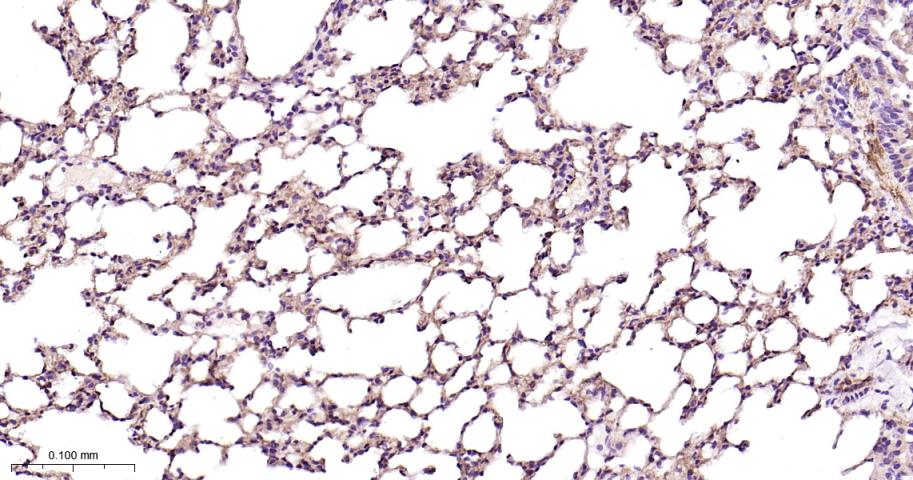 黑色素瘤细胞粘附分子CD146重组兔单抗
