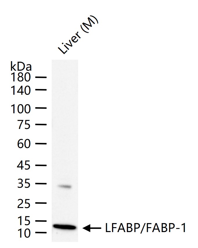 肝脏型脂肪酸结合蛋白重组兔单抗