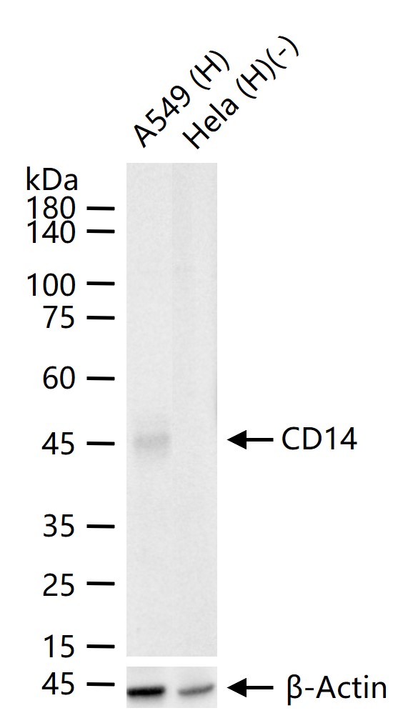 CD14重组兔单抗