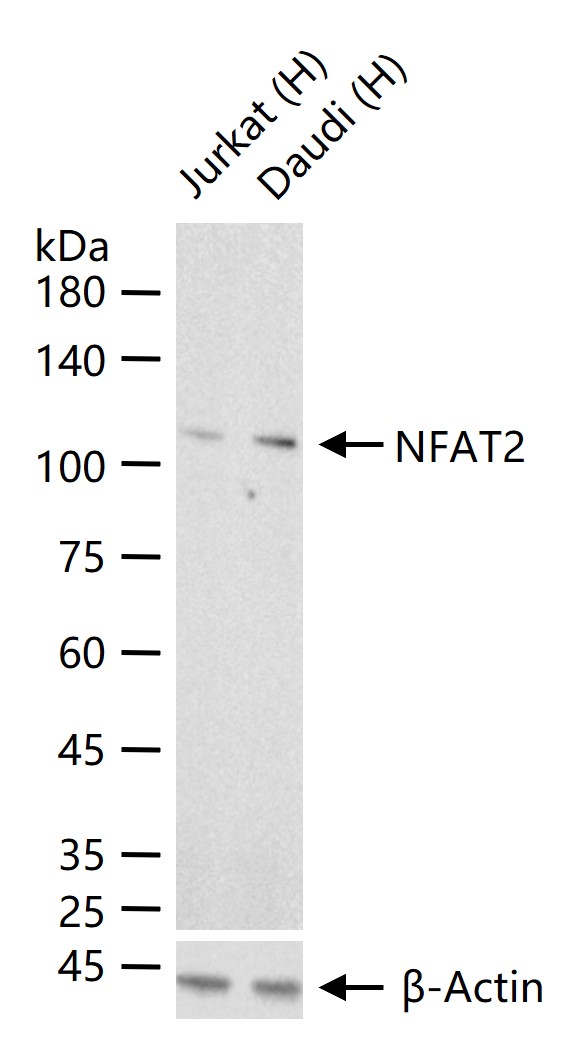 活化T细胞核因子1蛋白重组兔单抗
