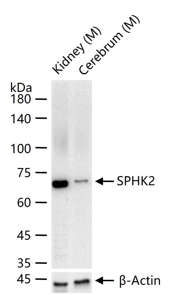 SPHK2 Rabbit pAb (一抗) - WB,IHC-P,IHC-F,IF,ELISA | Bioss