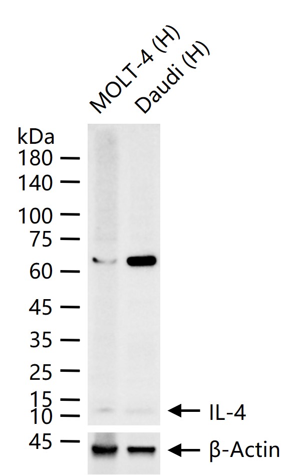 白介素4重组兔单抗