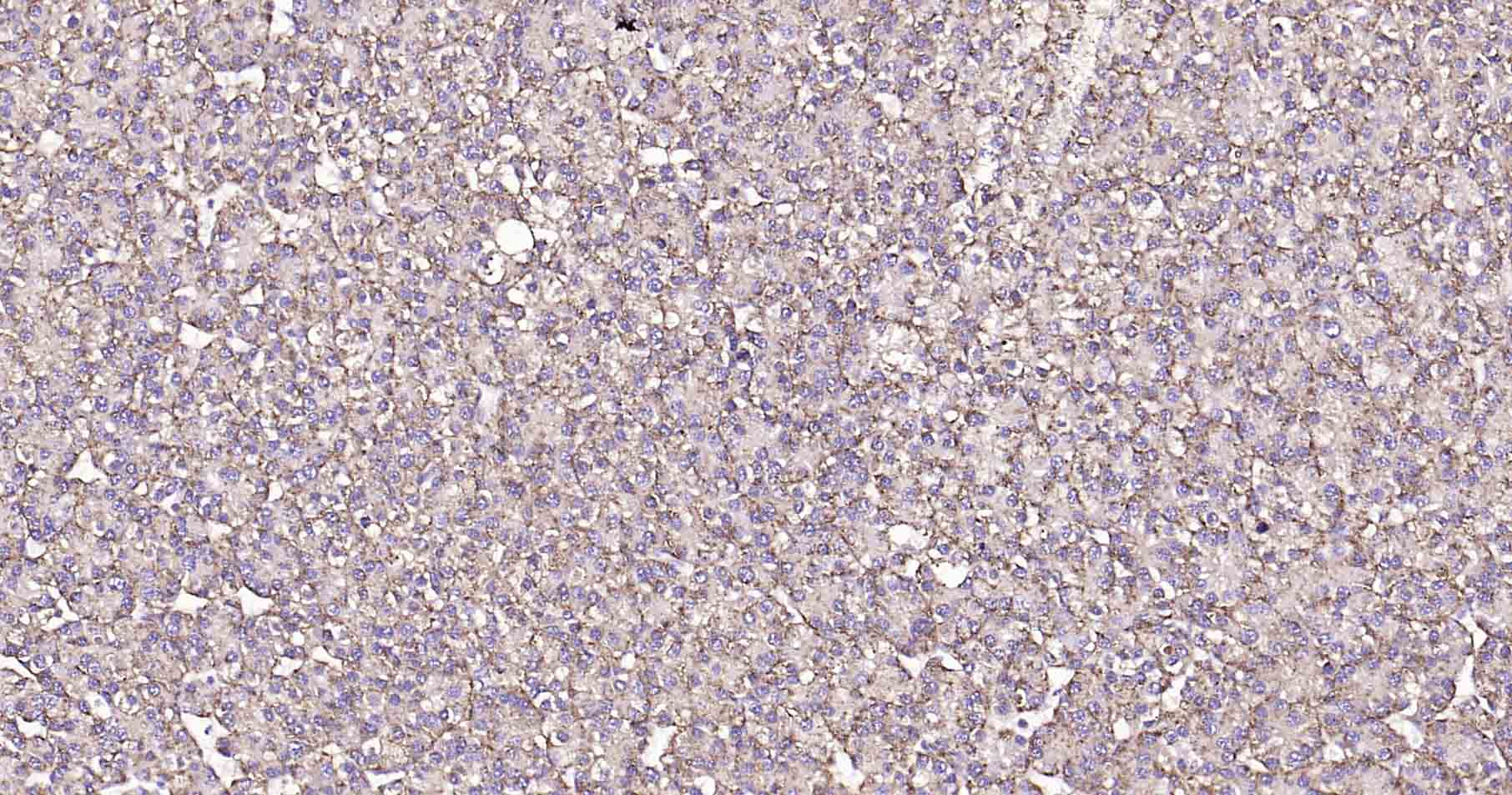 溶酶体相关膜蛋白1（CD107）抗体-bs-1970R