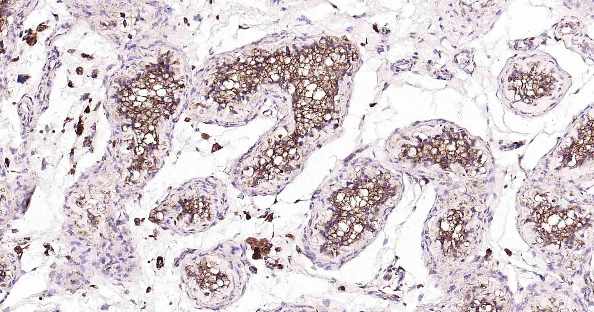 溶酶体相关膜蛋白1（CD107）抗体-bs-1970R