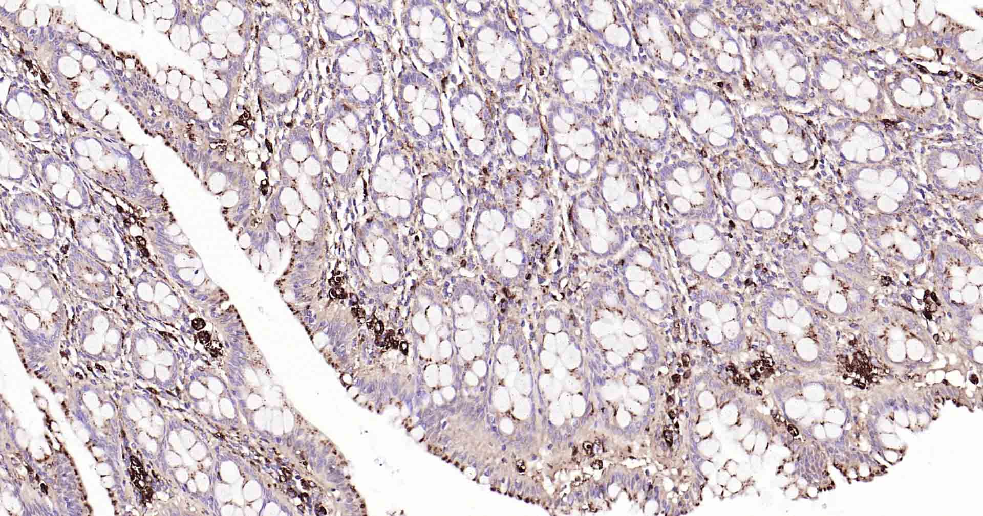 溶酶体相关膜蛋白1（CD107）抗体-bs-1970R