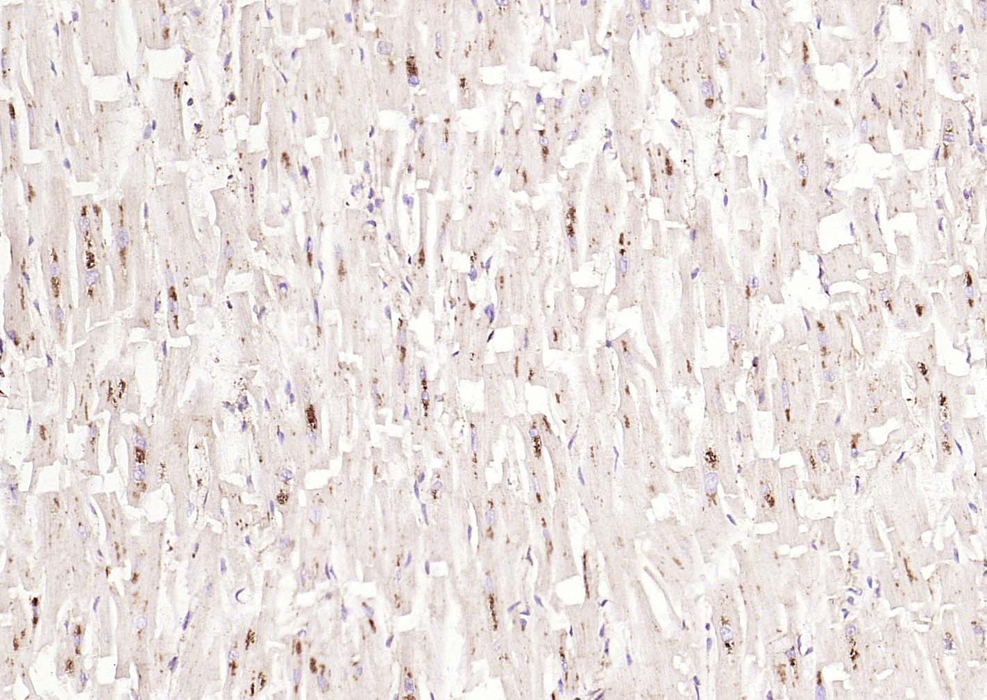 溶酶体相关膜蛋白1（CD107）抗体-bs-1970R