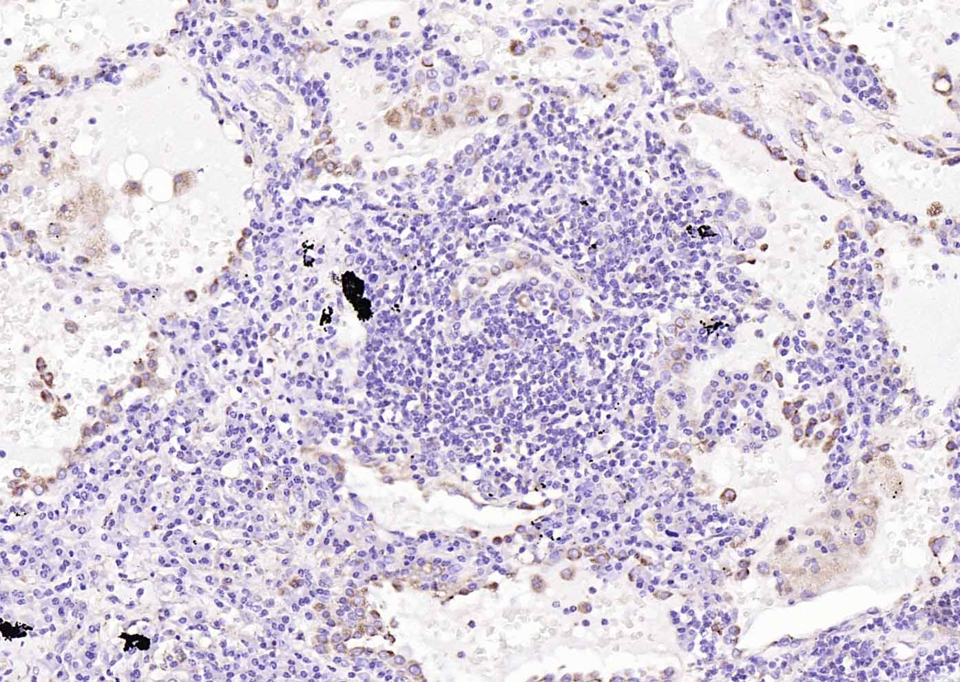 溶酶体相关膜蛋白1（CD107）抗体-bs-1970R