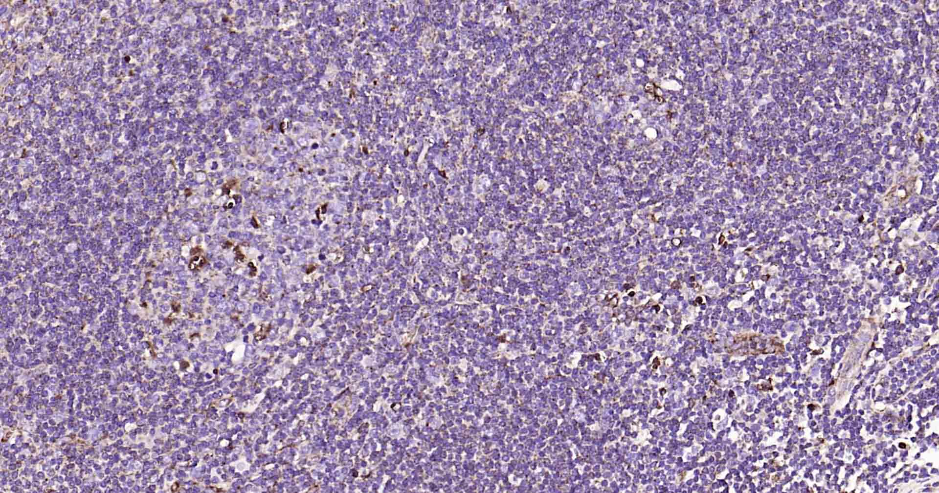 溶酶体相关膜蛋白1（CD107）抗体-bs-1970R