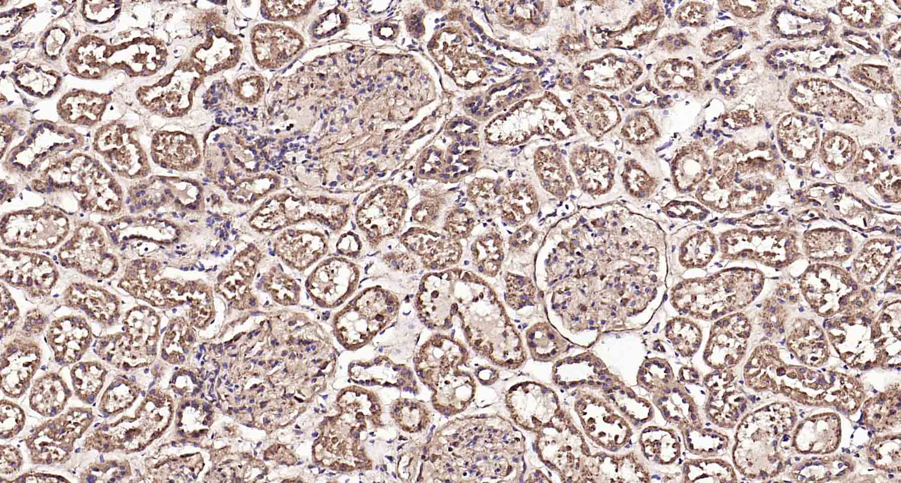 溶酶体相关膜蛋白1（CD107）抗体-bs-1970R