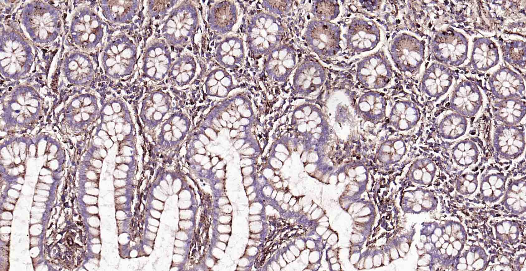 溶酶体相关膜蛋白1（CD107）抗体-bs-1970R