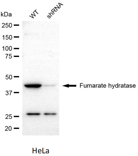 Fumarase/FH Mouse mAb (一抗) - WB,IHC-P,IHC-F,IF | Bioss