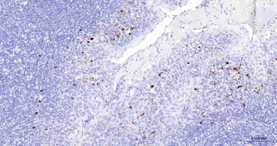 髓过氧化物酶单克隆抗体-bsm-43010M