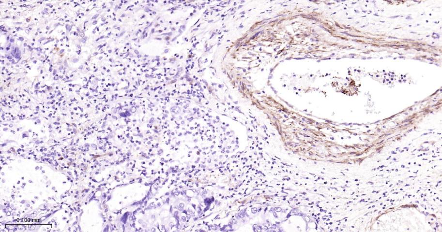 粘着斑蛋白（内参）重组兔单抗