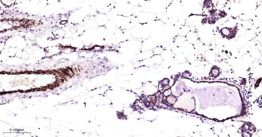 粘着斑蛋白（内参）重组兔单抗