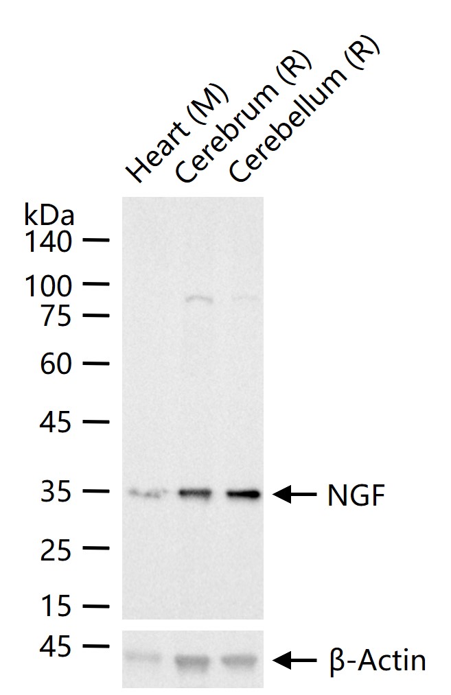 神经生长因子β重组兔单抗