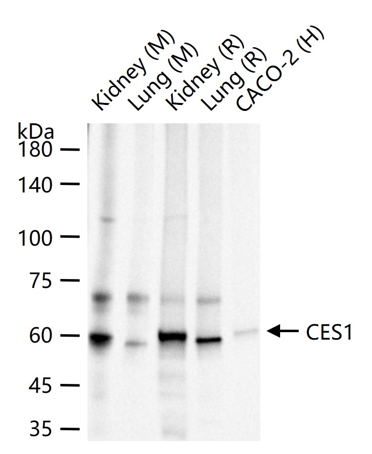 肝羧酸酯酶1重组兔单抗