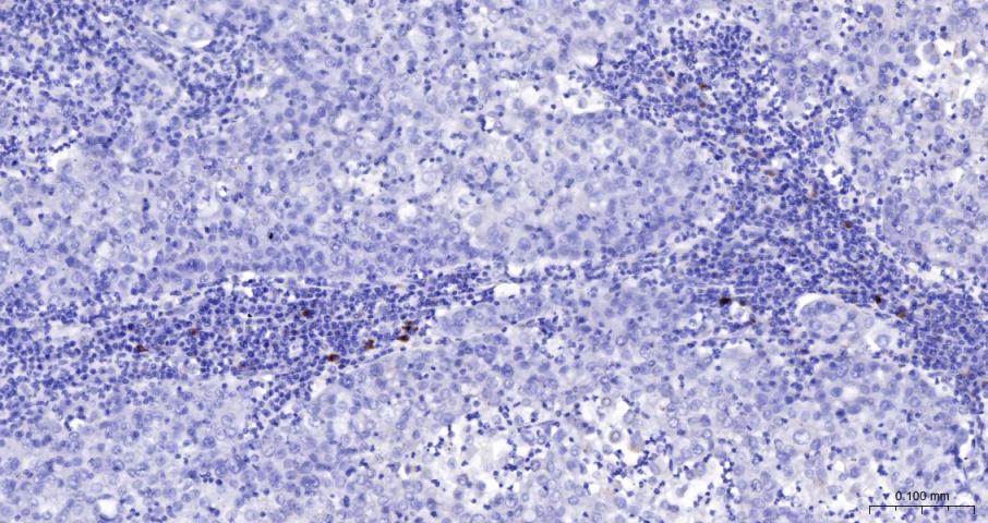 髓过氧化物酶单克隆抗体-bsm-43010M