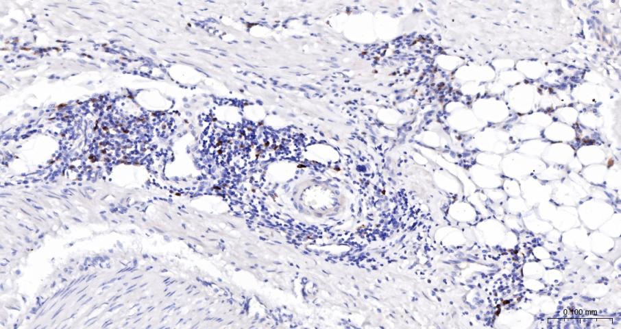 髓过氧化物酶单克隆抗体-bsm-43010M