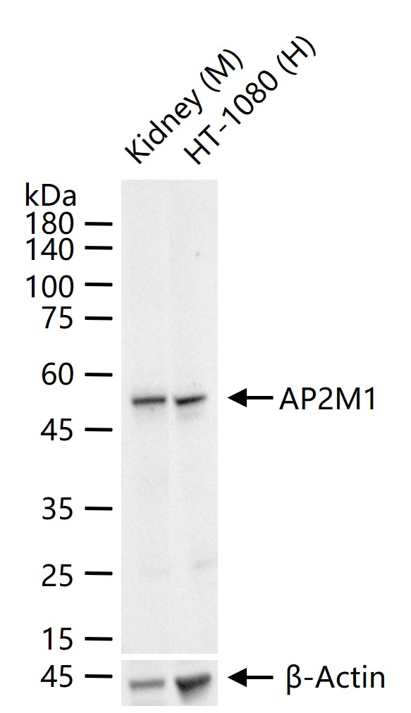 接头相关蛋白复合体AP-2μ链1重组兔单抗