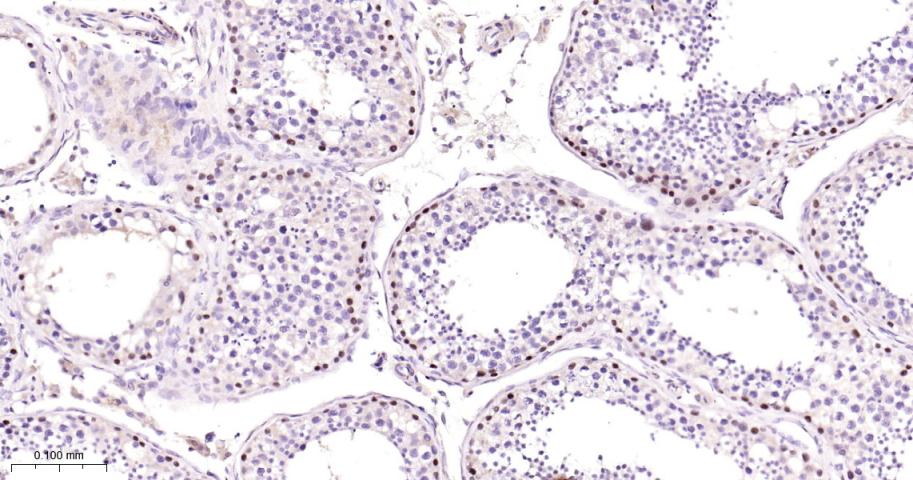 肿瘤错配修复基因PMS2重组兔单抗