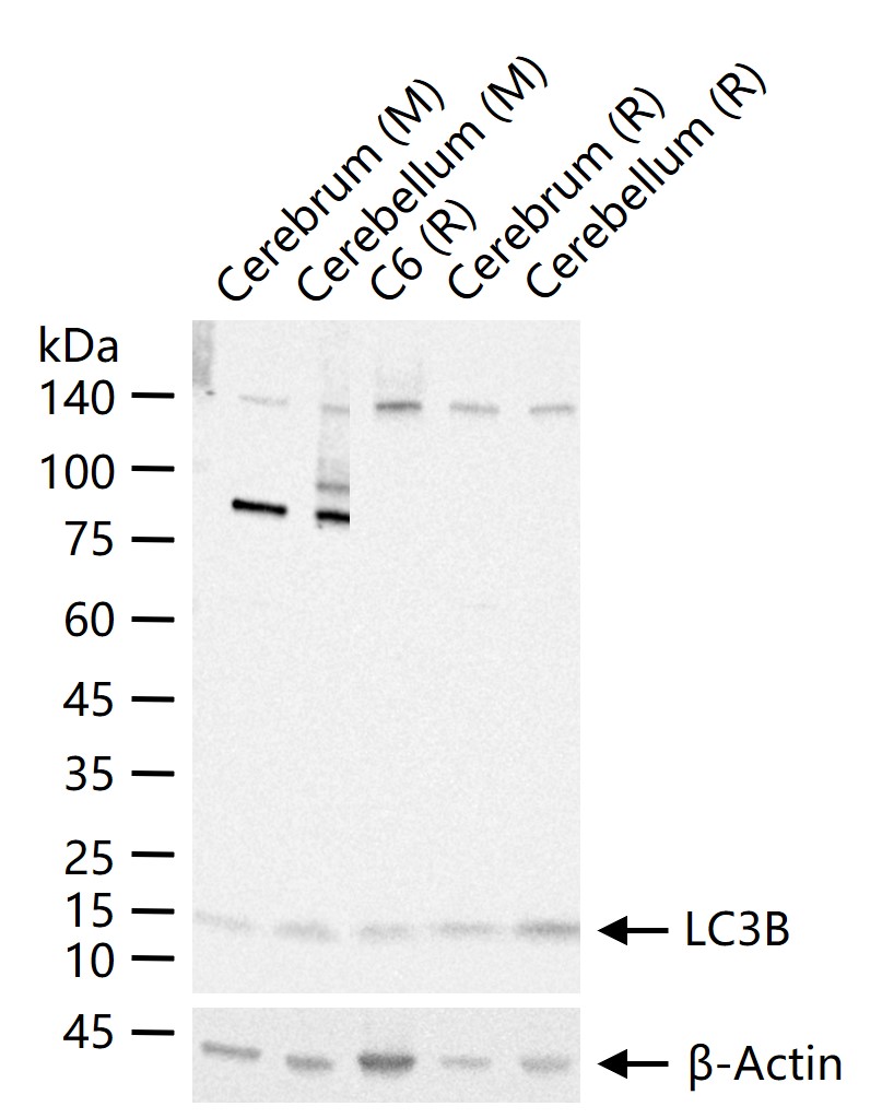 自噬微管相关蛋白轻链3重组兔单抗