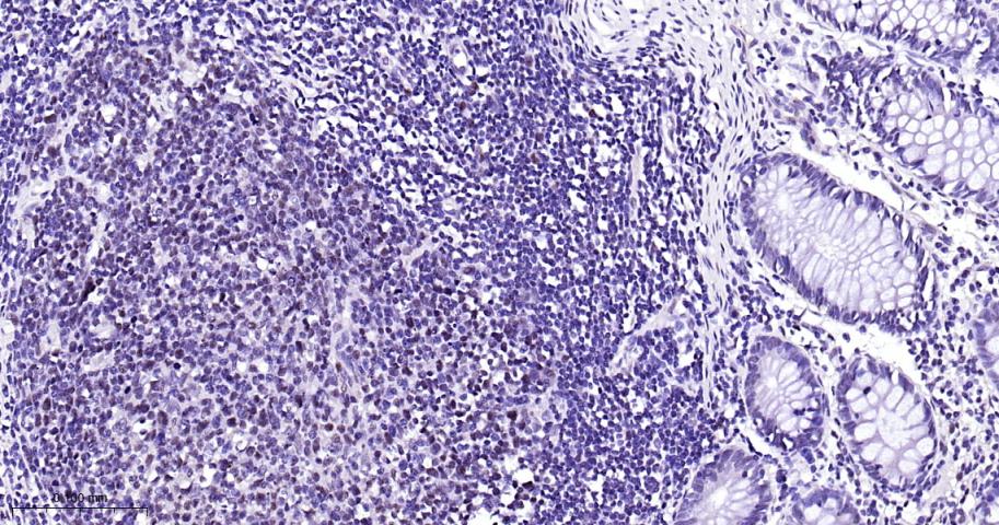 肿瘤错配修复基因PMS2重组兔单抗
