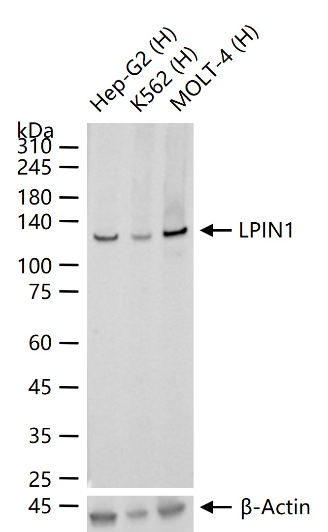 磷脂酸磷酸酯酶LPIN1重组兔单抗