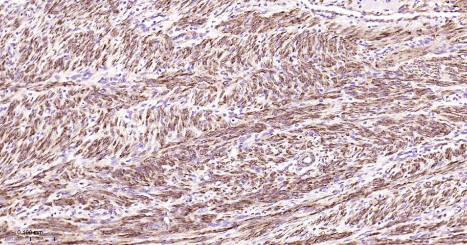 粘着斑蛋白（内参）重组兔单抗