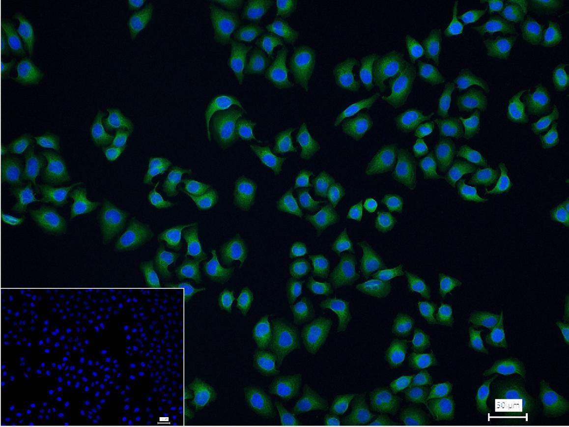 醌氧化还原酶抗体-bs-2184R