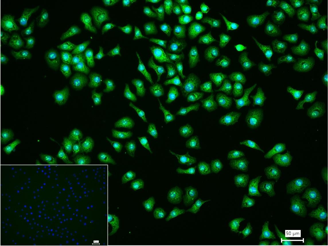 磷酸乙醇胺转移酶A重组兔单抗
