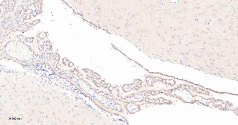 瘦素受体重组兔单抗