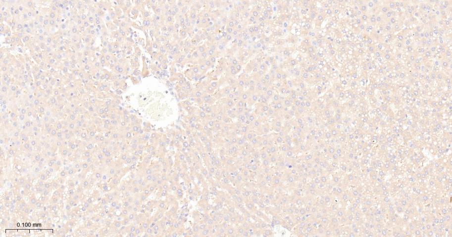 瘦素受体重组兔单抗