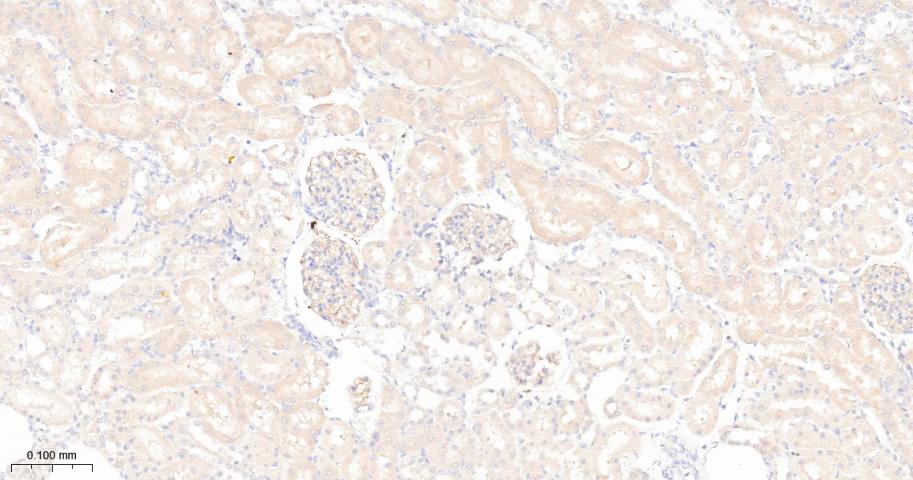瘦素受体重组兔单抗