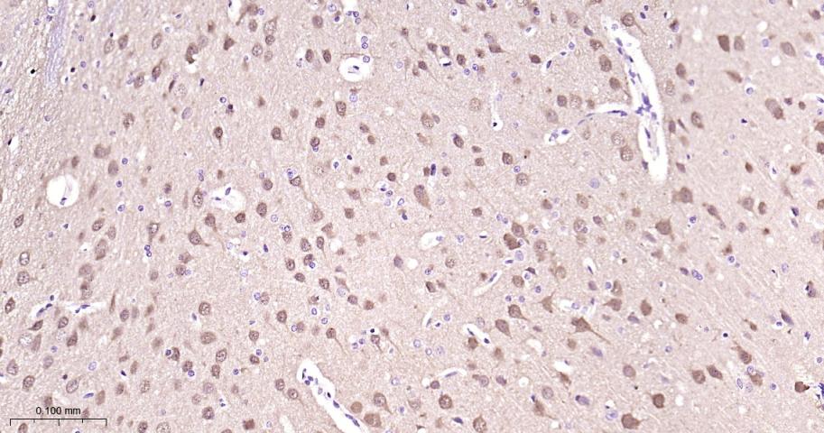 神经细胞胞浆蛋白9.5重组兔单抗