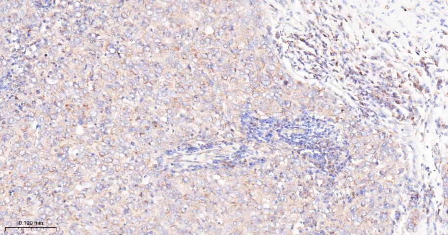 雷帕霉素靶蛋白重组兔单抗