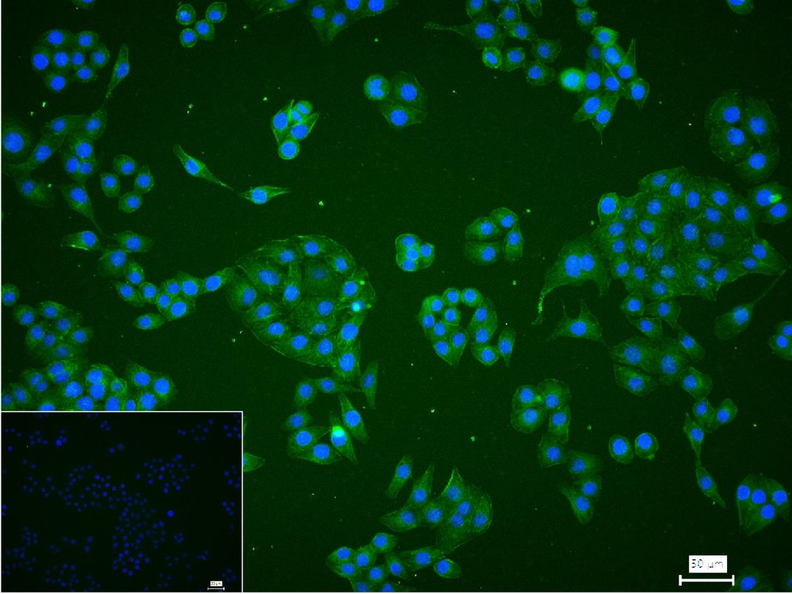 原癌基因蛋白c-kit(CD117)重组兔单抗
